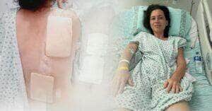 Após ação da Defensoria, moradora de Sinop realiza 1ª supermicrocirurgia para transplante de linfonodo na Bahia