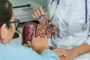 Quais são os sintomas da cirrose hepática?