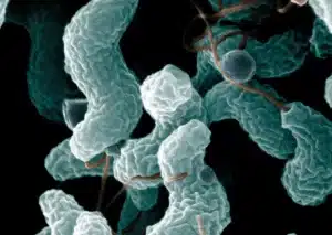 Síndrome de Guillain-Barré é contagiosa? Entenda doença que fez Peru declarar emergência de saúde