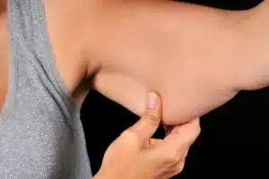 Truques caseiro para emagrecer os braços em pouco tempo