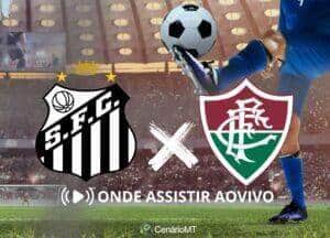 Santos x Fluminense