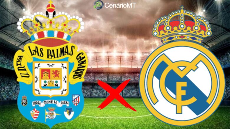 Onde assistir Las Palmas x Real Madrid