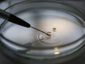 Brasília (DF), 29/02/2024 - Larvas são analisadas em laboratório da vigilância ambiental do DF para comprovação de que são do mosquito transmissor da dengue. Foto: Marcelo Camargo/Agência Brasil