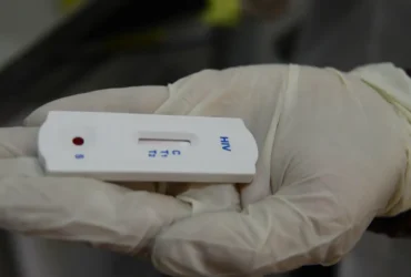 Saúde orienta farmácias sobre testes para HIV, sífilis e hepatites