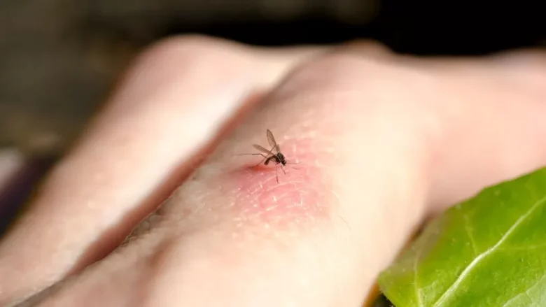 Surto de febre do Oropouche preocupa o país