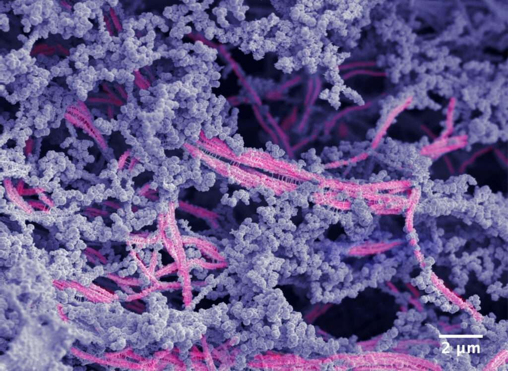 Inovação: Cientistas desenvolvem biomaterial que regenera cartilagem