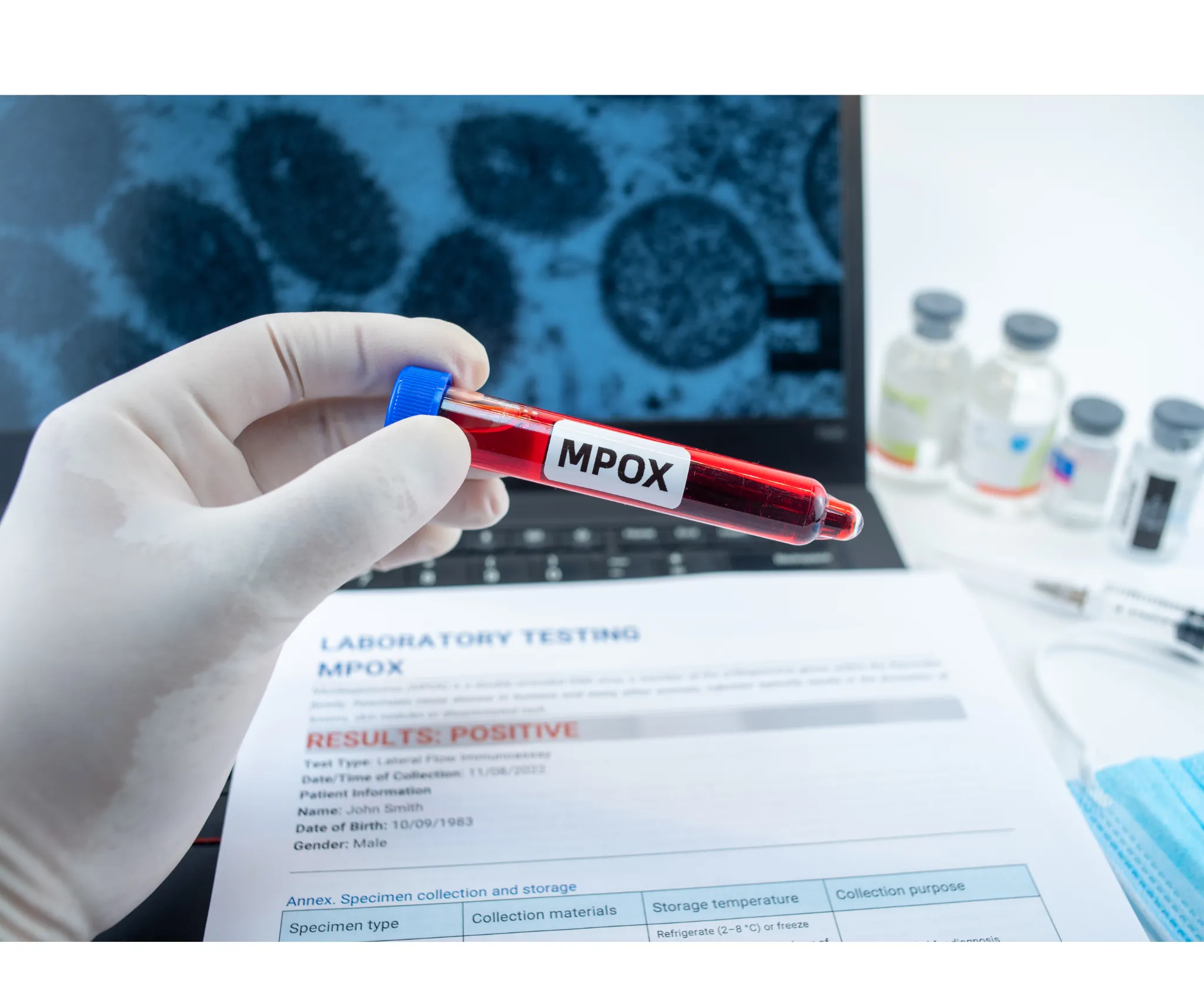 Mpox registra aumento de 225% em Mato Grosso