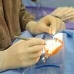 Hospital dos Olhos em Várzea Grande realiza mutirão de cirurgias de catarata pelo Programa Fila Zero