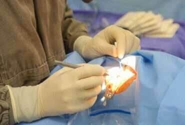 Hospital dos Olhos em Várzea Grande realiza mutirão de cirurgias de catarata pelo Programa Fila Zero