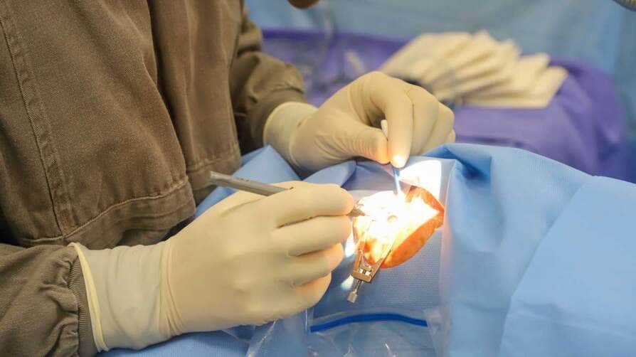 Hospital dos Olhos em Várzea Grande realiza mutirão de cirurgias de catarata pelo Programa Fila Zero