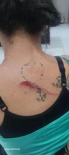 Suspeito sobe em viatura da GCM após agredir companheira com faca e tentar fugir em surto