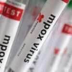 Teste positivo para Mpox 
20, 2024. REUTERS/Dado Ruvic/Illustration