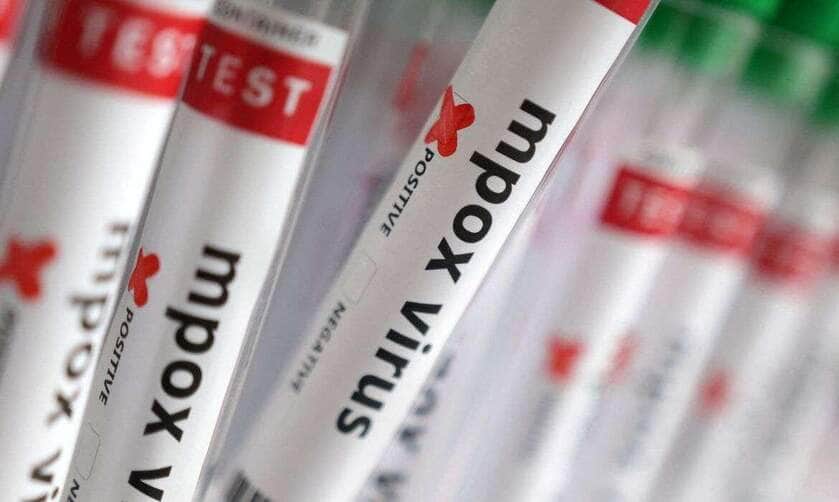 Teste positivo para Mpox 
20, 2024. REUTERS/Dado Ruvic/Illustration