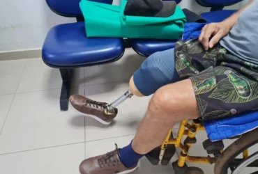 Cridac entrega 100 próteses sob medida em mutirão para pacientes de Mato Grosso