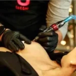 Projeto Y faz tatuagem para a reconstrução da aréola de mulheres que passaram por mastectomia.