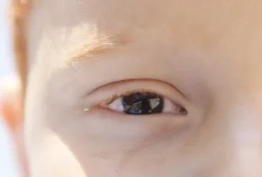 Refração é a principal causa de deficiência visual infantil no Brasil