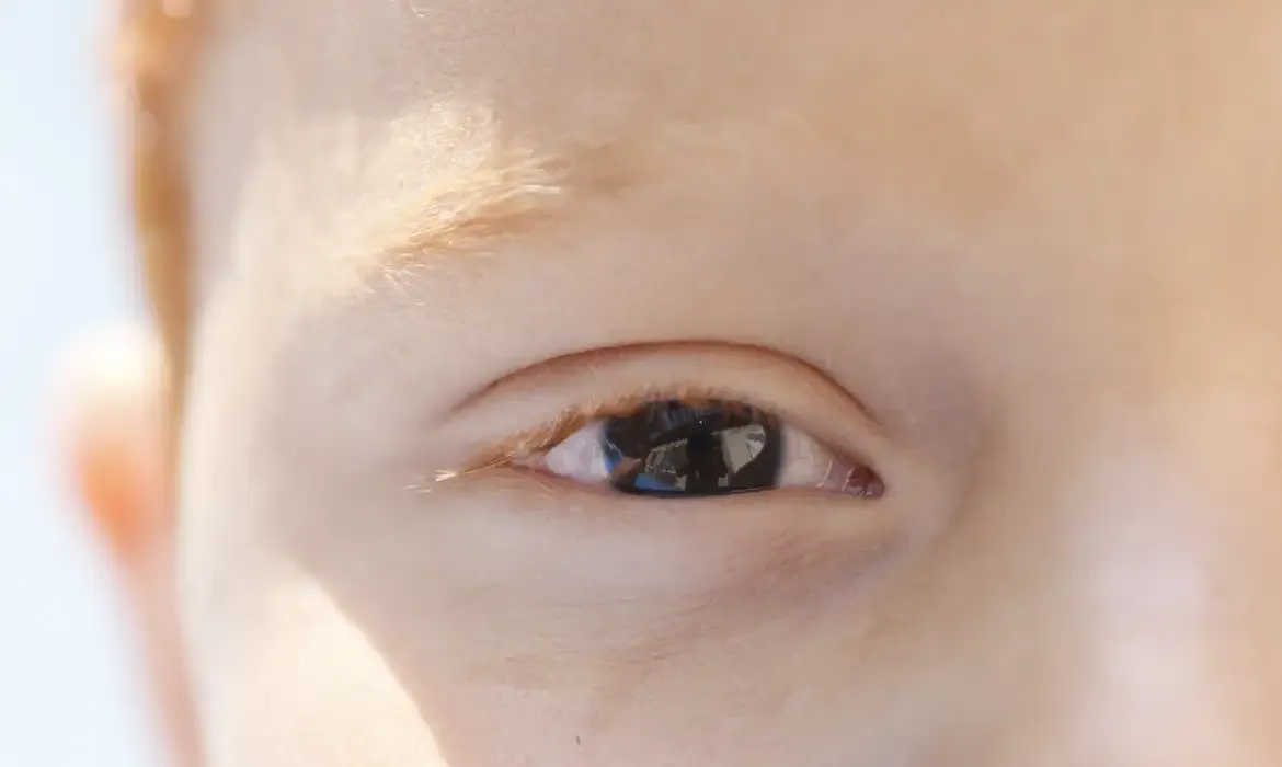 Refração é a principal causa de deficiência visual infantil no Brasil