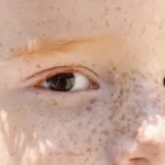 Reflexo branco nos olhos: entenda os riscos da leucocoria em bebês