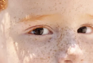 Reflexo branco nos olhos: entenda os riscos da leucocoria em bebês