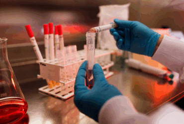 Coordenadora do Serviço de Atendimento Especializado (SAE), doutora Gabriela Porazzi, reforça a importância da testagem anual e do uso de preservativos para conter o avanço da infecção no município