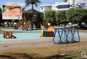 Manchas vermelhas surgiram na população de Lucas do Rio Verde. (Foto: Reprodução)