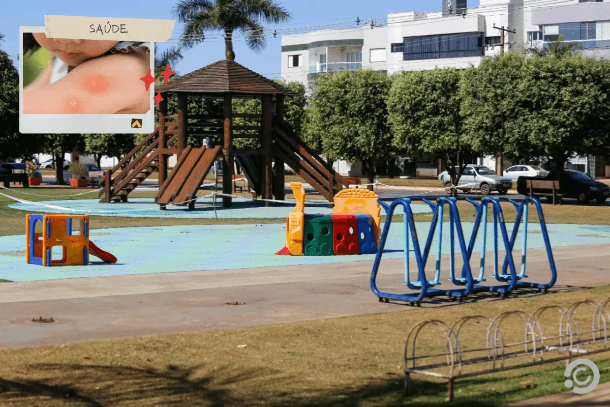 Manchas vermelhas surgiram na população de Lucas do Rio Verde. (Foto: Reprodução)