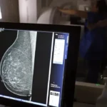 Falta de mamógrafos agrava desigualdade no combate ao câncer de mama no Brasil