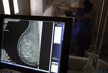 Falta de mamógrafos agrava desigualdade no combate ao câncer de mama no Brasil