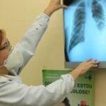 Brasil é destaque em encontro latino-americano sobre tuberculose - Eduardo Gomes - ILMD/Fiocruz Amazônia