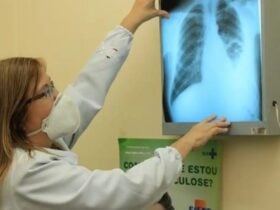 Brasil é destaque em encontro latino-americano sobre tuberculose - Eduardo Gomes - ILMD/Fiocruz Amazônia