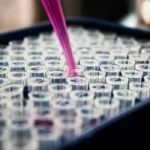 Inflamação no cérebro é apontada como chave no Alzheimer