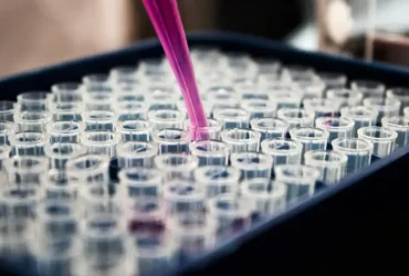 Inflamação no cérebro é apontada como chave no Alzheimer