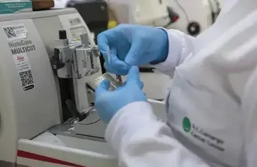 Câncer de próstata cresce 32% entre homens com menos de 50 anos no Brasil