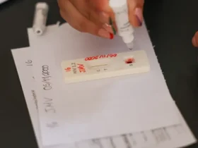 Hiv mobiliza ação com testagem rápida e orientação no Distrito Federal