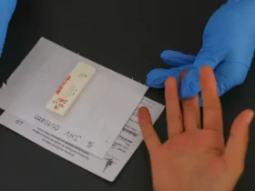 HIV avança no debate sobre acesso à PrEP de longa duração no Brasil