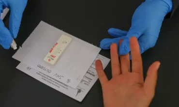 HIV avança no debate sobre acesso à PrEP de longa duração no Brasil