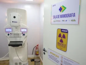 Mamografia passa a ser garantida no sus a partir dos 40 anos
