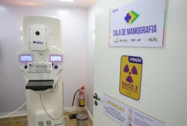 Mamografia passa a ser garantida no sus a partir dos 40 anos