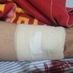 Homem é baleado de raspão em tentativa de homicídio durante a madrugada em Cáceres