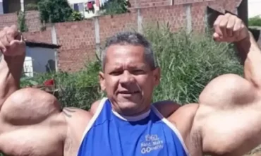 Morre Popeye Brasileiro, Arlindo de Souza, aos 55 anos em Pernambuco