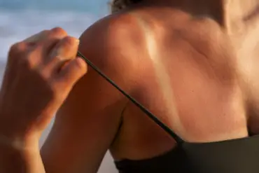 Marcas de pós-sol baratos e eficientes: opções que hidratam e recuperam a pele após o sol