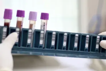 Mato Grosso integra projeto piloto do SUS para diagnostico de doencas raras via exame genetico -CenárioMT