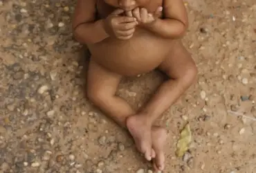 Desigualdade social afeta crescimento e peso de crianças no Brasil