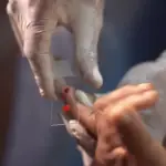 Malária ganha novo tratamento infantil no SUS para ampliar controle da doença