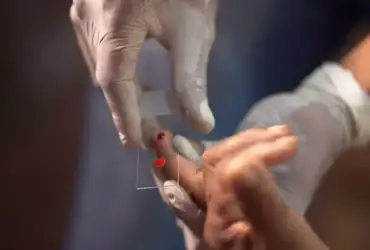 Malária ganha novo tratamento infantil no SUS para ampliar controle da doença