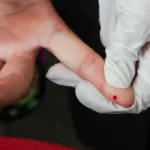 Dengue passa a ter teste rápido disponível no SUS em todo o país