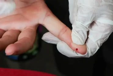 Dengue passa a ter teste rápido disponível no SUS em todo o país