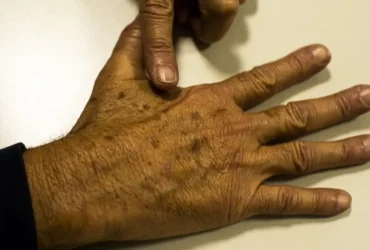 Câncer: falhas em dados oficiais prejudicam diagnóstico precoce no Brasil