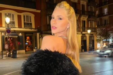 Alopecia: Virgínia Fonseca revela diagnóstico e desabafa sobre doença autoimune
