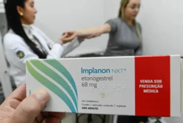 Implanon amplia acesso no SUS com qualificação de profissionais